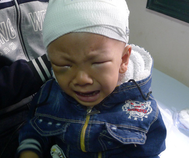 Đau đớn cảnh mẹ ung thư hạch, con ung thư võng mạc
